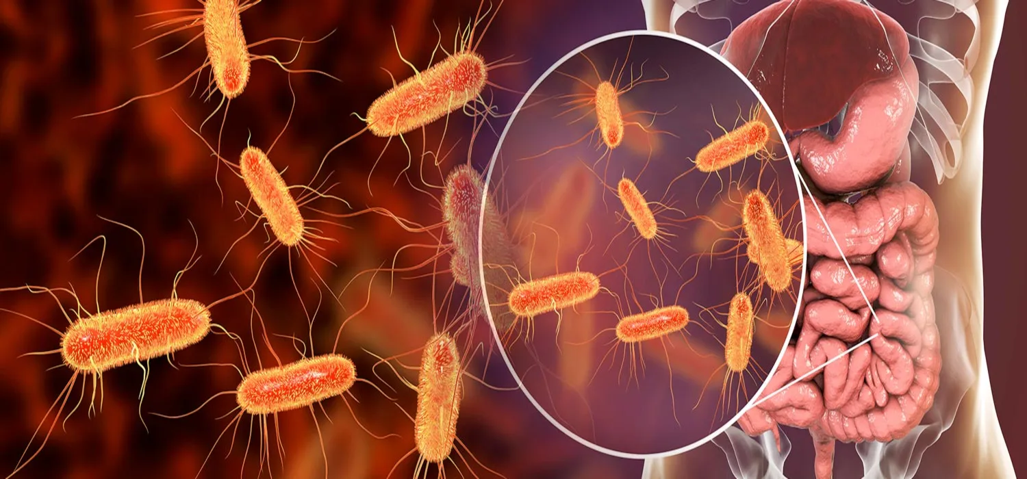 E. Coli Outbreak Tied to McDonald’s Quarter Pounder Sparks Warning