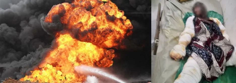 Gas Explosion in Ebonyi Catering School Severely Injures 10 Students